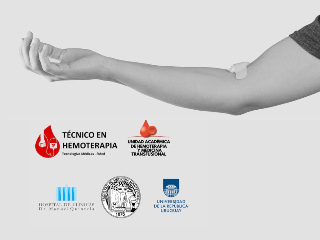 Gráfico de fondo gris en el que se ve la fotografía de un brazo extendido horizontalmente , con una curación de gasas, como alguien que recién donó sangre. 

Sobreimpresos aparecen los logos de la Udelar, Técnico en Hemoterápia, Unidad Académica de Hemoterapia y Medicina Transfusional, y el Hospital de Clínicas, 